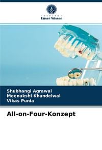 Produktbild: All-on-Four-Konzept