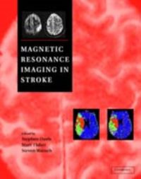 Produktbild: Magnetic Resonance Imaging in Stroke