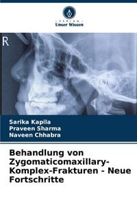 Produktbild: Behandlung von Zygomaticomaxillary-Komplex-Frakturen - Neue Fortschritte