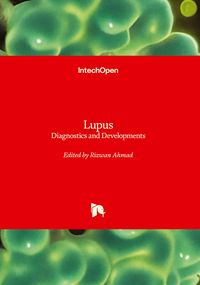 Produktbild: Lupus - Diagnostics and Developments