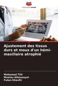 Produktbild: Ajustement des tissus durs et mous d'un h&eacute;mi-maxillaire atrophi&eacute;