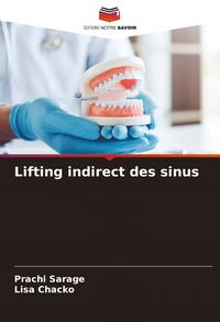 Produktbild: Lifting indirect des sinus