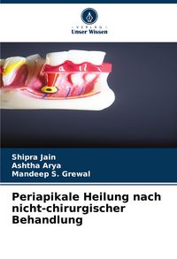 Produktbild: Periapikale Heilung nach nicht-chirurgischer Behandlung