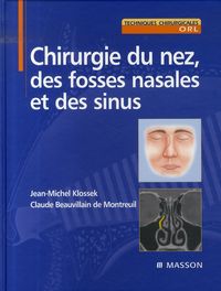 Produktbild: Chirurgie du Nez, des Fosses Nasales et des Sinus