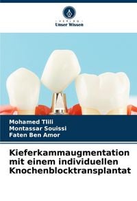 Produktbild: Kieferkammaugmentation mit einem individuellen Knochenblocktransplantat