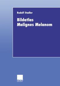 Produktbild: Bildatlas Malignes Melanom