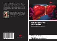 Produktbild: Tumors and liver metastases