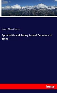 Produktbild: Spondylitis and Rotary Lateral Curvature of Spine