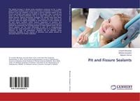 Produktbild: Pit and Fissure Sealants