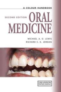 Produktbild: Lewis, M: Oral Medicine