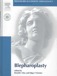 Produktbild: Blepharoplasty [With DVD-ROM]