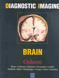 Produktbild: Diagnostic Imaging: Brain