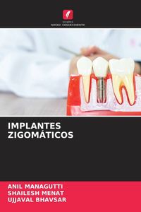 Produktbild: Implantes Zigom&aacute;ticos