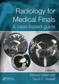 Produktbild: Radiology for Medical Finals
