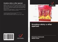Produktbild: Grzybice sk&oacute;ry u ofiar oparze&iquest;