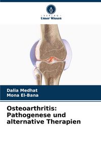 Produktbild: Osteoarthritis: Pathogenese und alternative Therapien