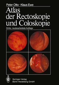 Produktbild: Atlas der Rectoskopie und Coloskopie