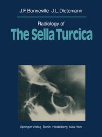 Produktbild: Radiology of The Sella Turcica