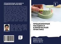 Produktbild: Precizionnye Nasadki V Klinicheskoj Praktike