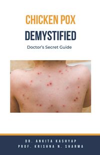 Produktbild: Chickenpox Demystified