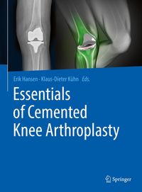 Produktbild: Essentials of Cemented Knee Arthroplasty