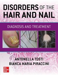 Produktbild: Disorders of the Hair and Nail: Diagnosis and Treatment