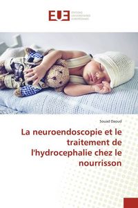 Produktbild: La neuroendoscopie et le traitement de l'hydrocephalie chez le nourrisson