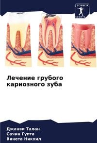 Produktbild: Lechenie grubogo karioznogo zuba