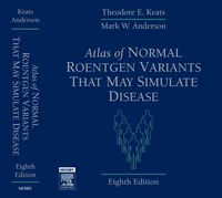 Produktbild: Atlas of Normal Roentgen Variants That May Simulate Disease