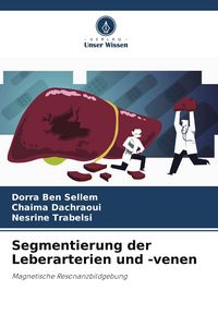 Produktbild: Segmentierung der Leberarterien und -venen