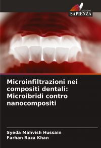 Produktbild: Microinfiltrazioni nei compositi dentali: Microibridi contro nanocompositi