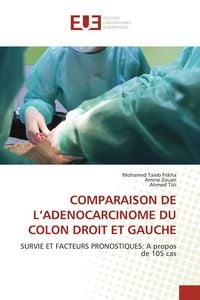 Produktbild: Comparaison De L'adenocarcinome Du Colon Droit Et Gauche