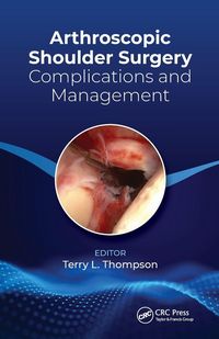 Produktbild: Arthroscopic Shoulder Surgery