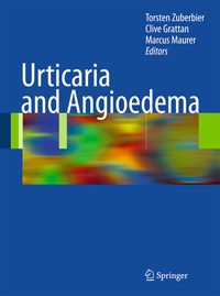 Produktbild: Urticaria and Angioedema