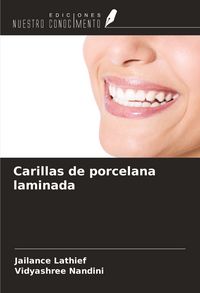 Produktbild: Carillas de porcelana laminada