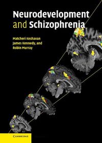 Produktbild: Neurodevelopment and Schizophrenia