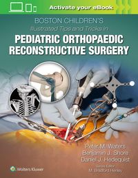 Produktbild: Boston Children's Illustrated Tips and Tricks in Pediatric Orthopaedic Reconstructive Surgery