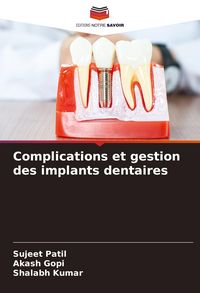Produktbild: Complications et gestion des implants dentaires
