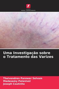 Produktbild: Uma Investiga&ccedil;&atilde;o sobre o Tratamento das Varizes