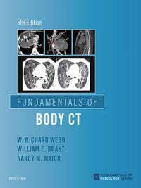 Produktbild: Fundamentals of Body CT E-Book