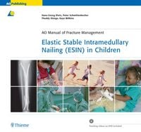 Produktbild: Elastic Stable Intramedullary Nailing (ESIN) in Children
