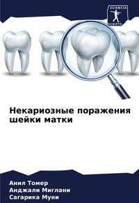 Produktbild: Nekarioznye porazheniq shejki matki