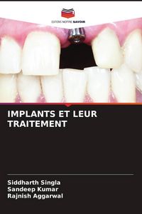 Produktbild: Implants Et Leur Traitement