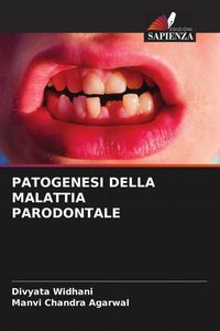 Produktbild: Patogenesi Della Malattia Parodontale