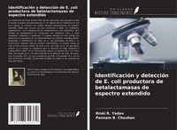Produktbild: Identificaci&oacute;n y detecci&oacute;n de E. coli productora de betalactamasas de espectro extendido