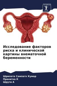 Produktbild: Issledowanie faktorow riska i klinicheskoj kartiny wnematochnoj beremennosti