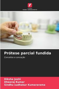 Produktbild: Pr&oacute;tese parcial fundida