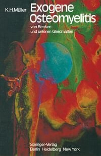 Produktbild: Exogene Osteomyelitis von Becken und unteren Gliedma&szlig;en