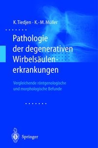 Produktbild: Pathologie der degenerativen Wirbels&auml;ulenerkrankungen