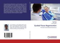 Produktbild: Guided Tissue Regeneration